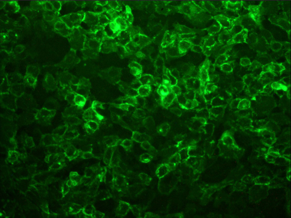 IF of A431 cells expressing GFP-E-cadherin labeled with DSHB antibody DSHB-GFP-4C9 against green fluorescent protein (GFP). Image Credit: DSHB.
